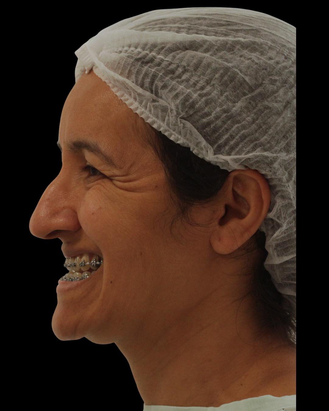 cirurgiaortognaticaportoalegrecirurgiabucomaxilofacial233 (1) cirurgiaortognaticaportoalegrecirurgiabucomaxilofacial233 (1)